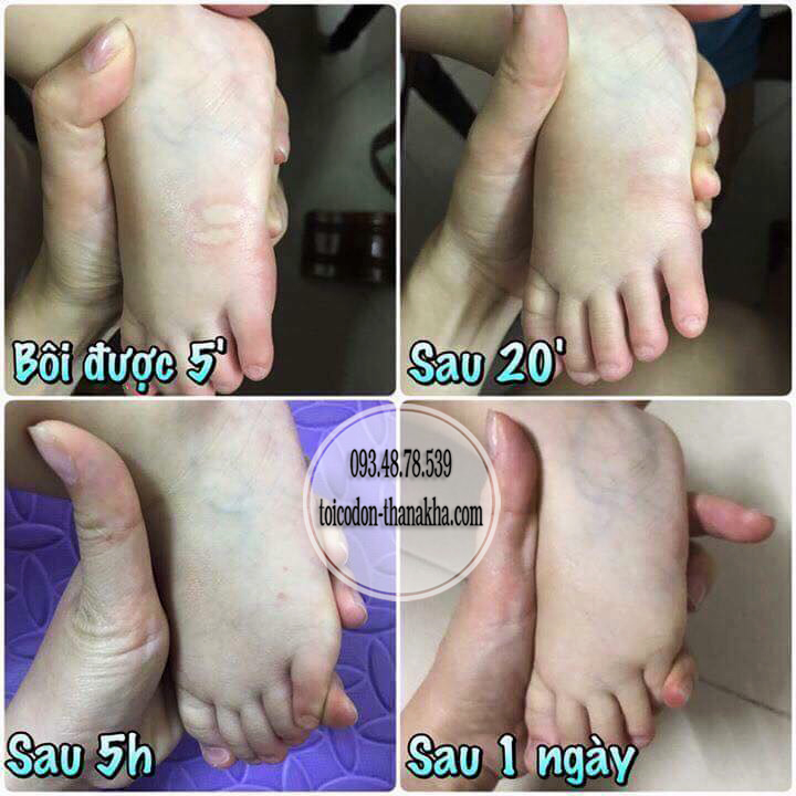 Dầu cù là thảo dược Green Balm Mosquito