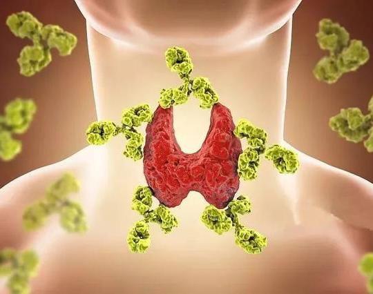 ưng thư tuyến giáp