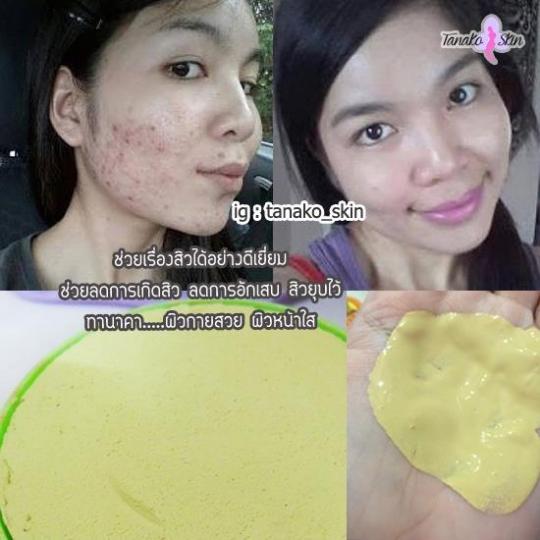 thanakha, thanaka, bột thanakha