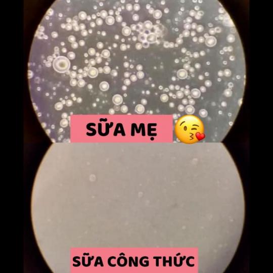SỮA MẸ THỰC SỰ CÓ TỐT???